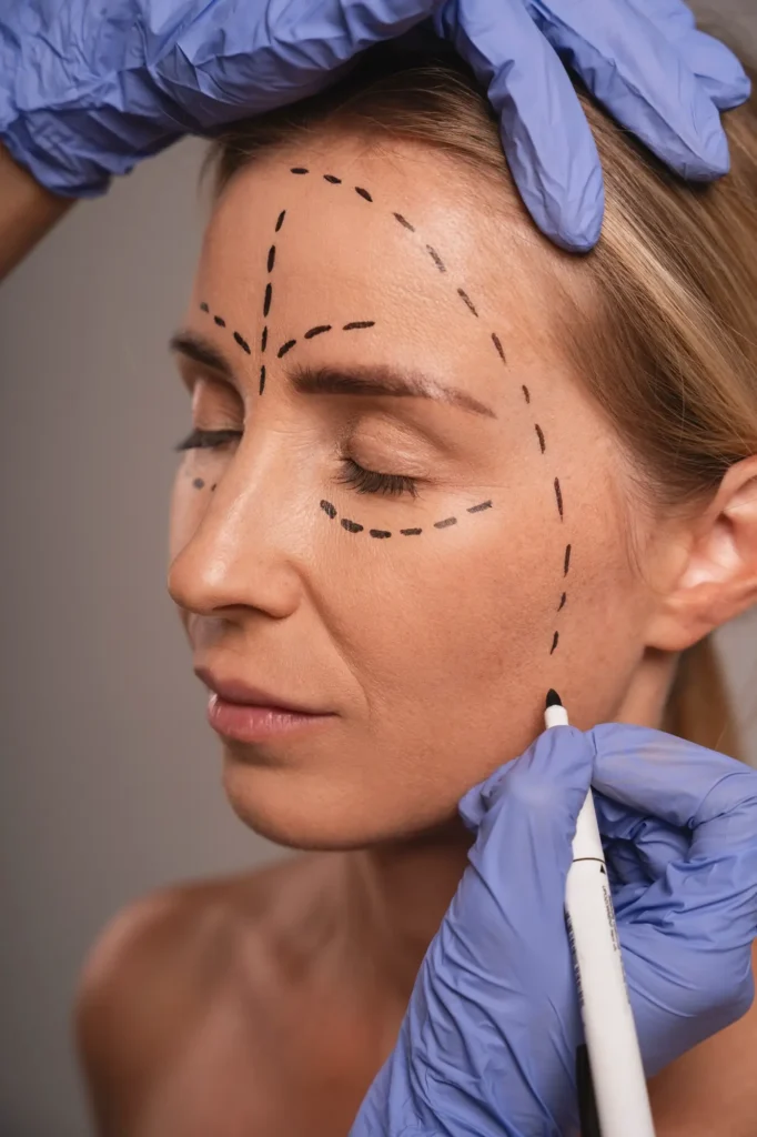 Armonización facial para equilibrar los rasgos faciales en madrid Doctor Gonzalo Alvarez