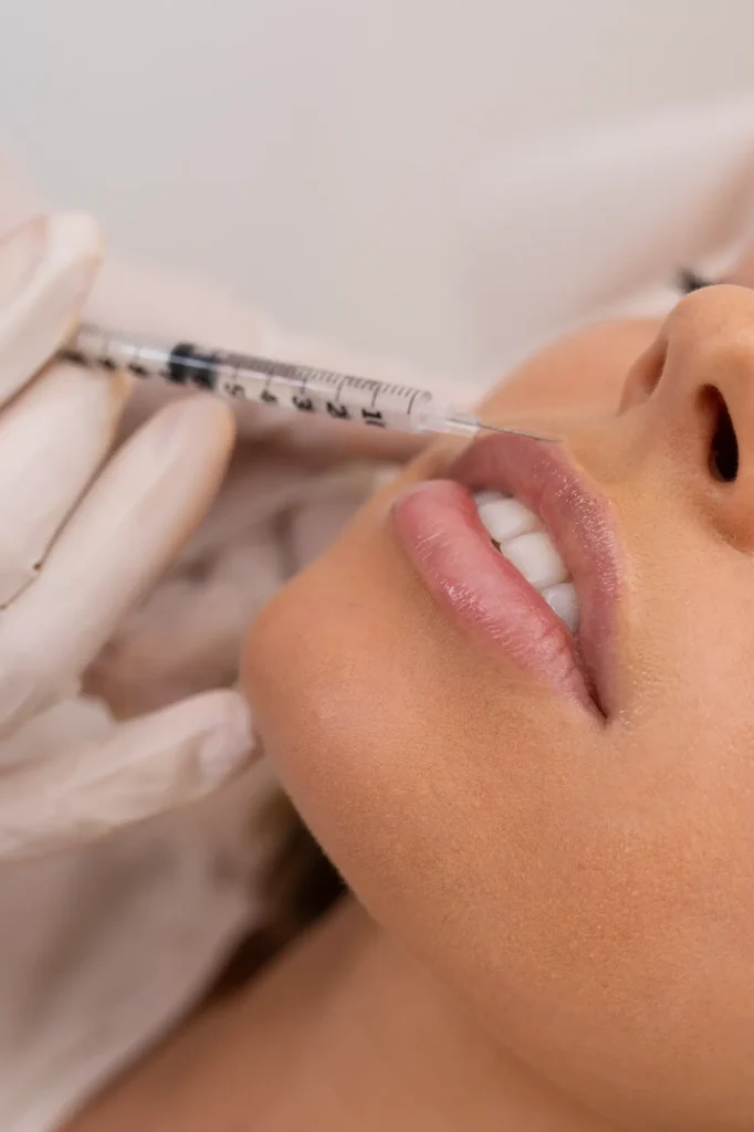 Corrección de Líneas de Expresión Profundas en madrid Doctor Gonzalo Alvarez