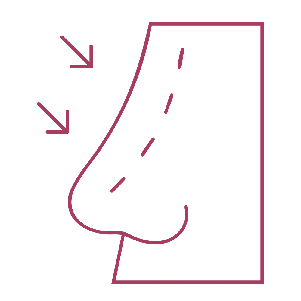 Doctor Gonzalo Alvarez medicina estética corrección de nariz en madrid _