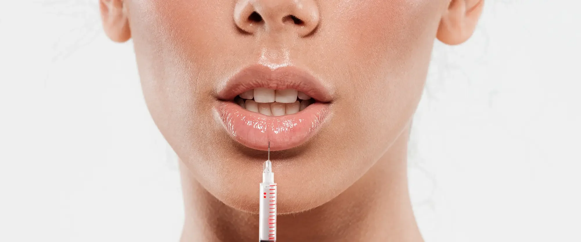 Medicina estética labios en madrid Doctor Gonzalo Alvarez