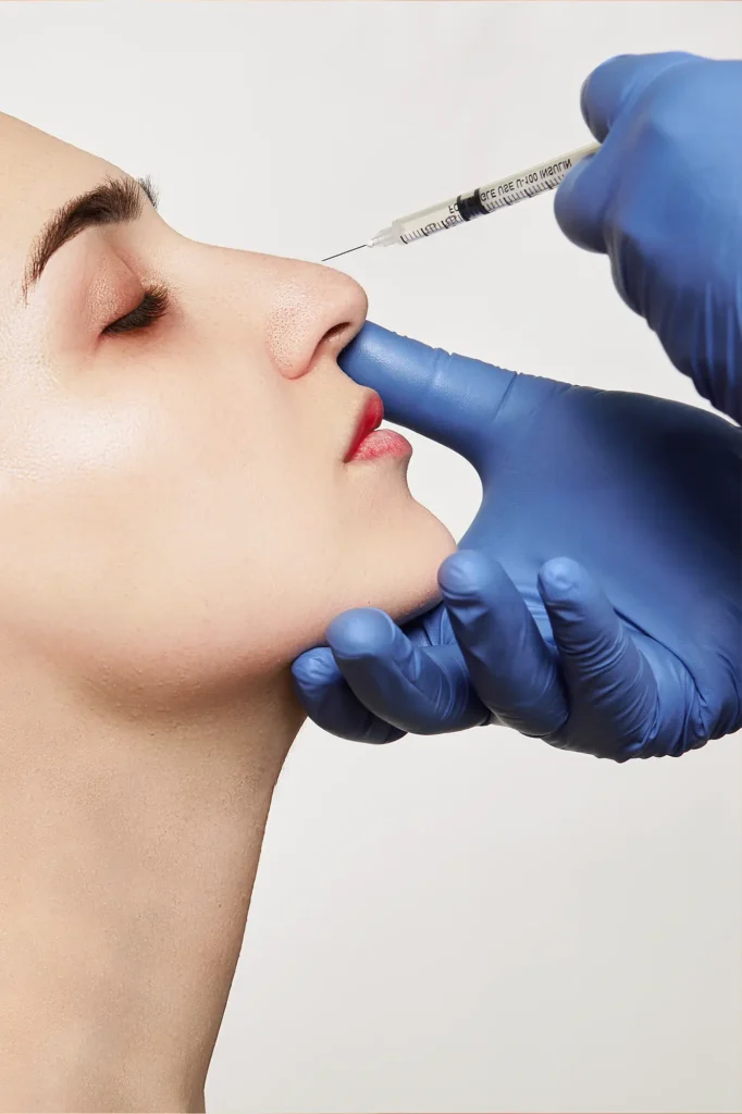 medicina estética corrección de nariz en madrid Doctor Gonzalo Alvarez